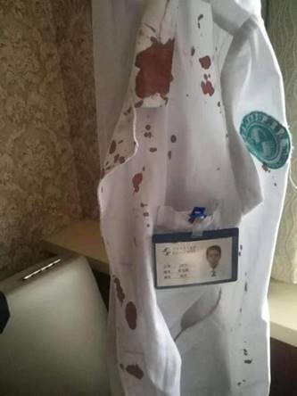 猩红热后期一定要验尿吗,猩红热需要上报么