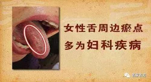 舌头是人体健康的晴雨表,舌头是健康的信号灯