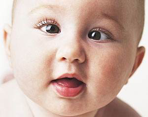 新生儿特殊生理现象照片,新生儿的正常生理现象