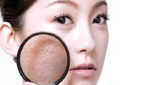 女生毛孔粗大有黑头怎么改善,油性皮肤毛孔粗大最好的改善方法