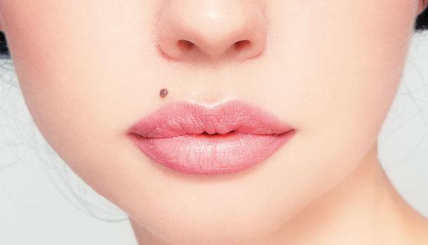 只能手术去除的痣有没有必要去除,身上的大面积痣有必要去掉吗