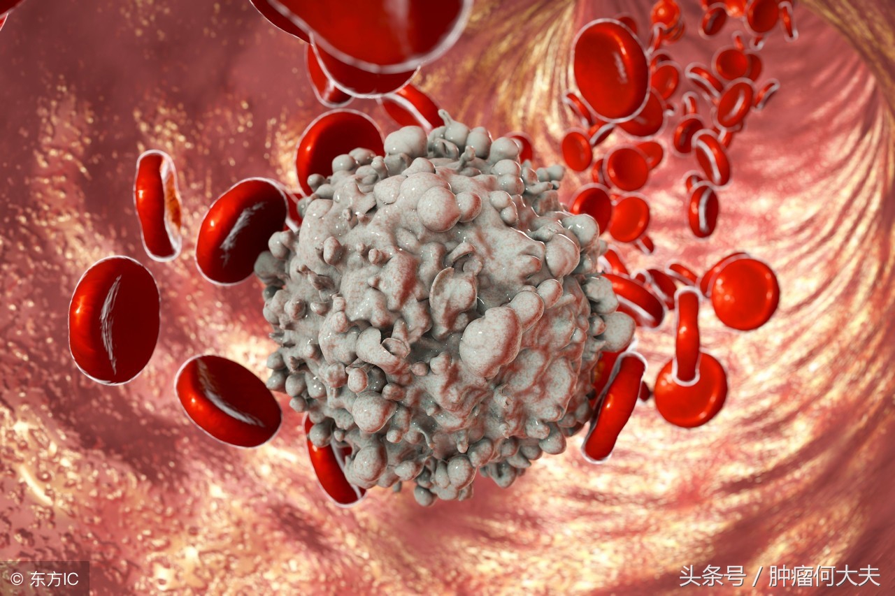 白细胞没有持续性增高是白血病吗,白细胞异常增高是白血病吗