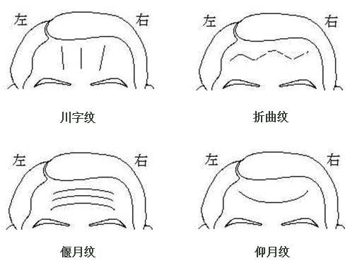 额头上有四条纹路代表什么,额头上三条纹路代表什么