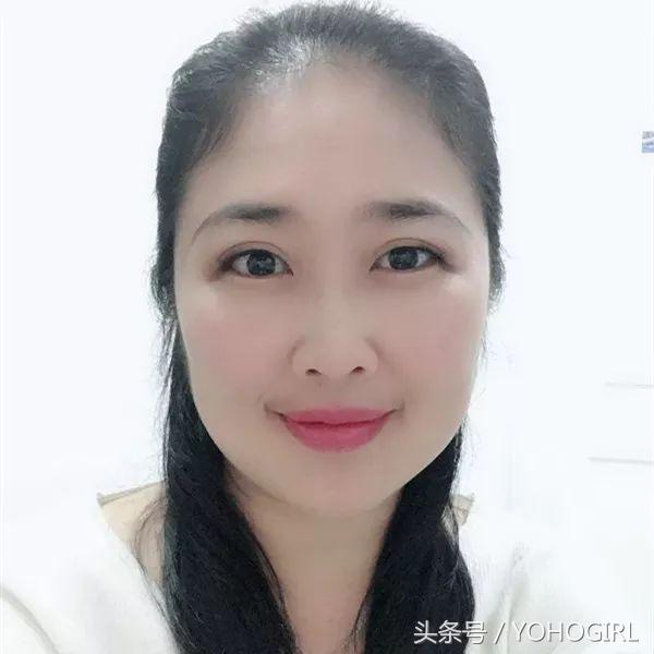 最基础最全面的医美项目是什么,有哪些比较好的医美项目