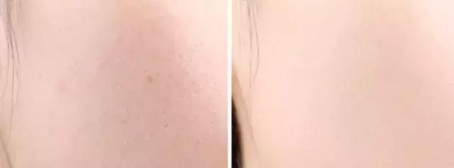 十大最好用粉底排行平价,全球公认最好用的粉底液平价