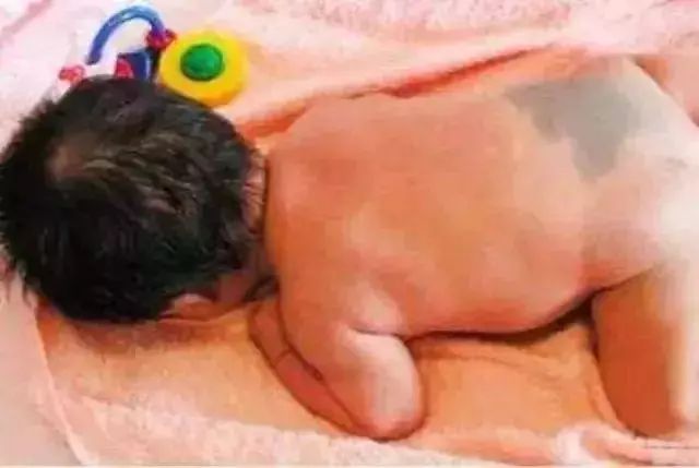 宝宝出生后遇到这种情况不用怕，儿科医生告诉你怎么应对系列3？