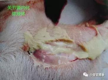 脓包型痤疮怎么治疗,脓包的最佳治疗方法