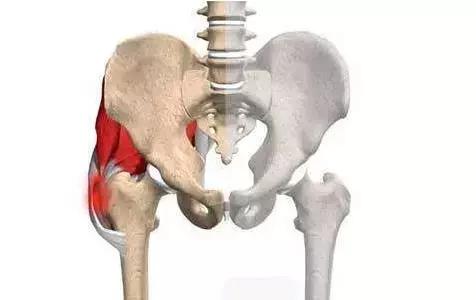 股骨头坏死病因及危险因素,股骨头容易坏死的部位