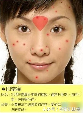 35岁女性脸上反复长痘痘怎么调理,下巴长满痘痘是什么原因怎么调理