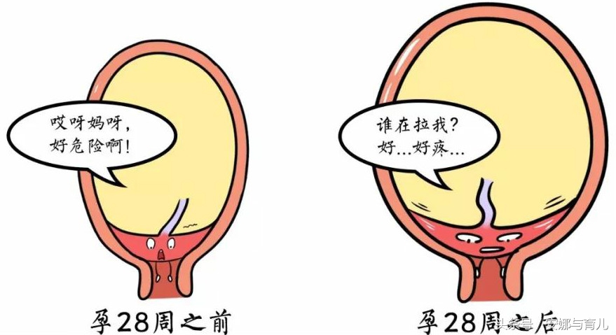 边缘性前置胎盘产检内容,产检查出唐氏儿怎么办