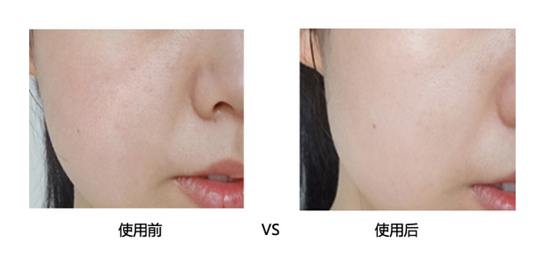 一个星期去闭口大作战！原来用这些“水”那么简单就去闭口了！