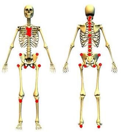 强直性脊柱炎查b27阴性说明什么,强直性脊柱炎哪些食物不可吃