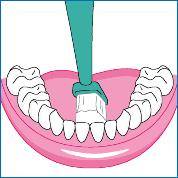 同样是大红唇，牙齿白的她擦就比你美！有办法让黄的牙齿白回来吗