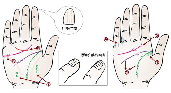 疾病与面相,面相看病人生死之秘诀