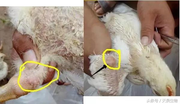 万病之源始于毒素,万病之源起于情志不畅