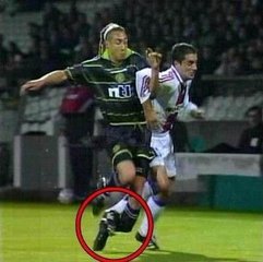 足球被爆头,足球守门员被爆头