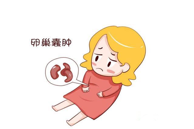 卵巢囊肿怎么判断良性还是恶性,产检发现卵巢囊肿