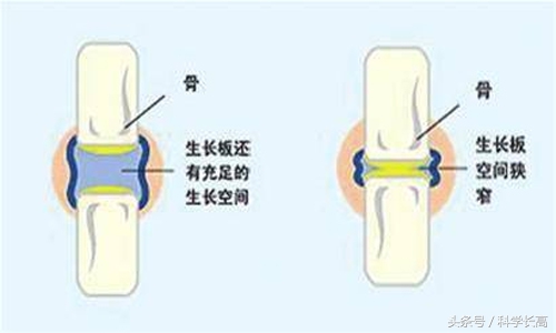 变声前长高还是变声后长高,青春期孩子变声会影响长高吗