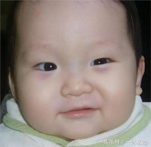 现在的孩子为什么都容易有黑眼圈,黑眼圈警告晚睡的小朋友