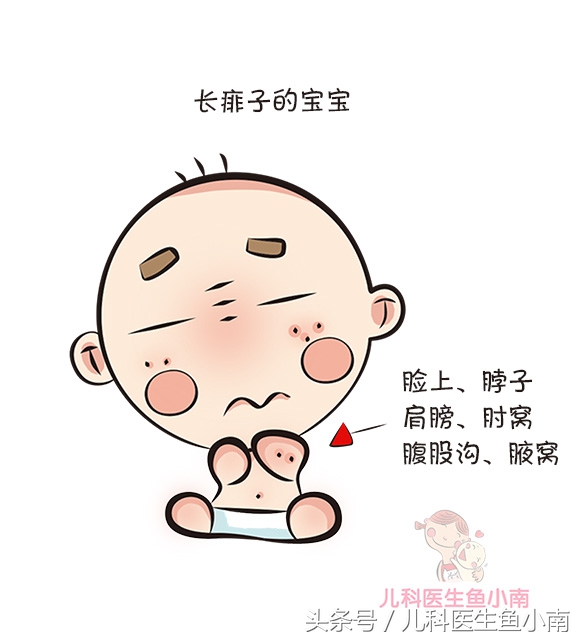 宝宝湿疹热疹区别,宝宝湿疹和热疹怎么观察