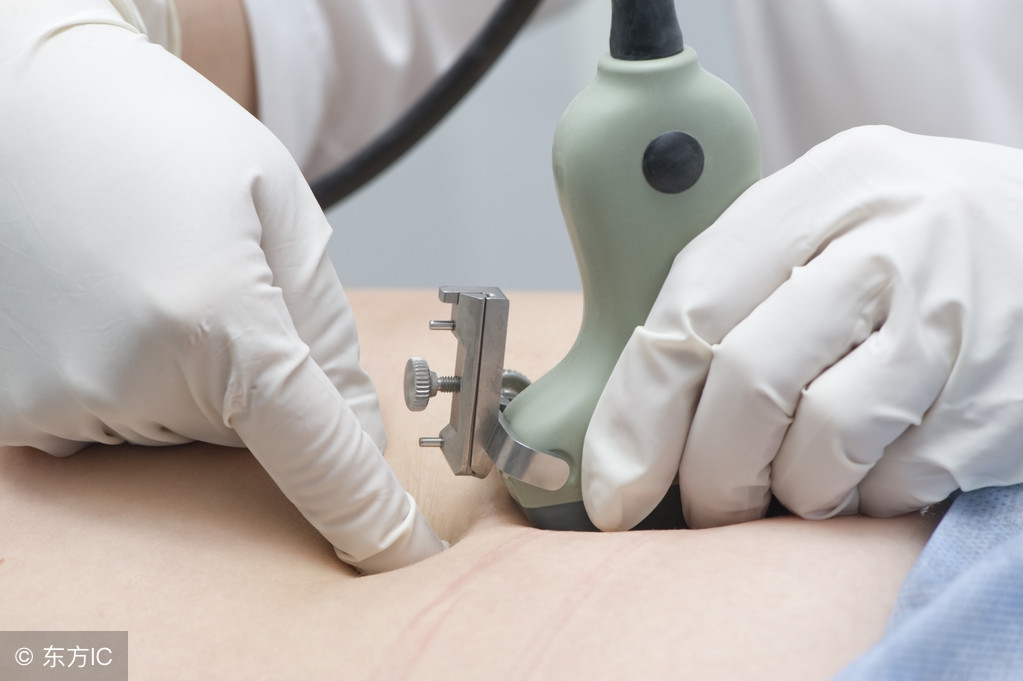 无创检查低风险还用做羊穿吗,羊穿和羊水穿刺是同一个意思吗