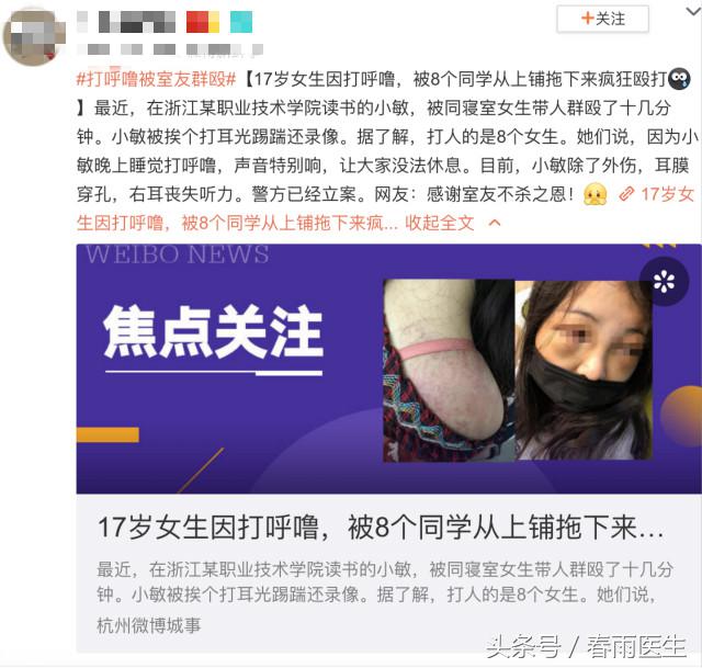 17岁女孩因打呼噜被舍友群殴,打鼾的我究竟应该怎么办?