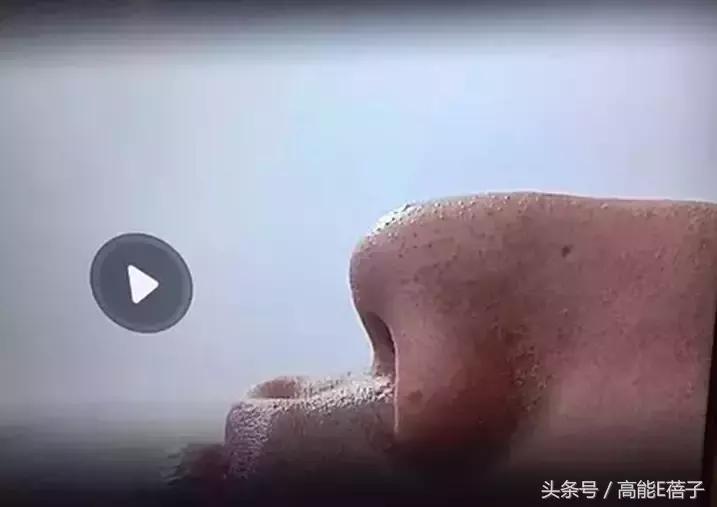 别傻了！蔡徐坤、Angelababy都根治不掉的黑头，微商神器能去除？