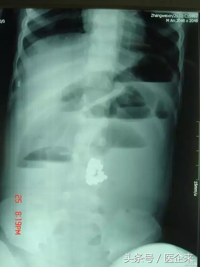 不可思议奇怪的东西,不可思议小物件穿透