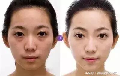 深度剖析医美整形的危害,医美整形该如何避坑呢