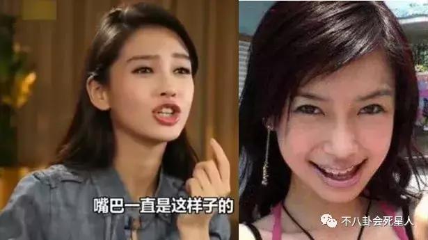 高圆圆戴牙套的脸型变化图,高圆圆戴牙套前后对比照