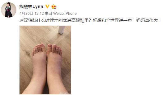 熊黛林产后修复,熊黛林产后跑步瘦身