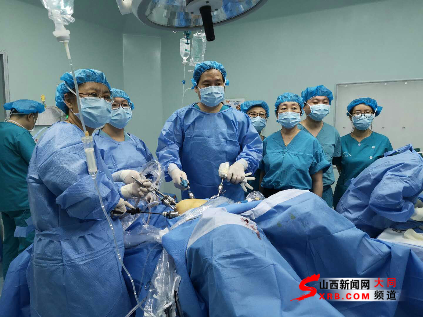 首例全腹腔镜直肠切除术完成,腹腔镜手术可治疗内膜异位吗