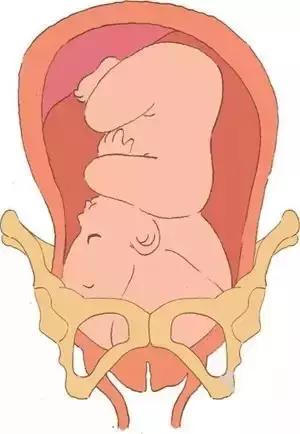 子宫脱垂、漏尿、腰痛、妇科病？当心！可能是你的盆底肌在作祟