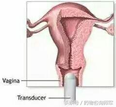 女性不可不知的6大妇科常规检查