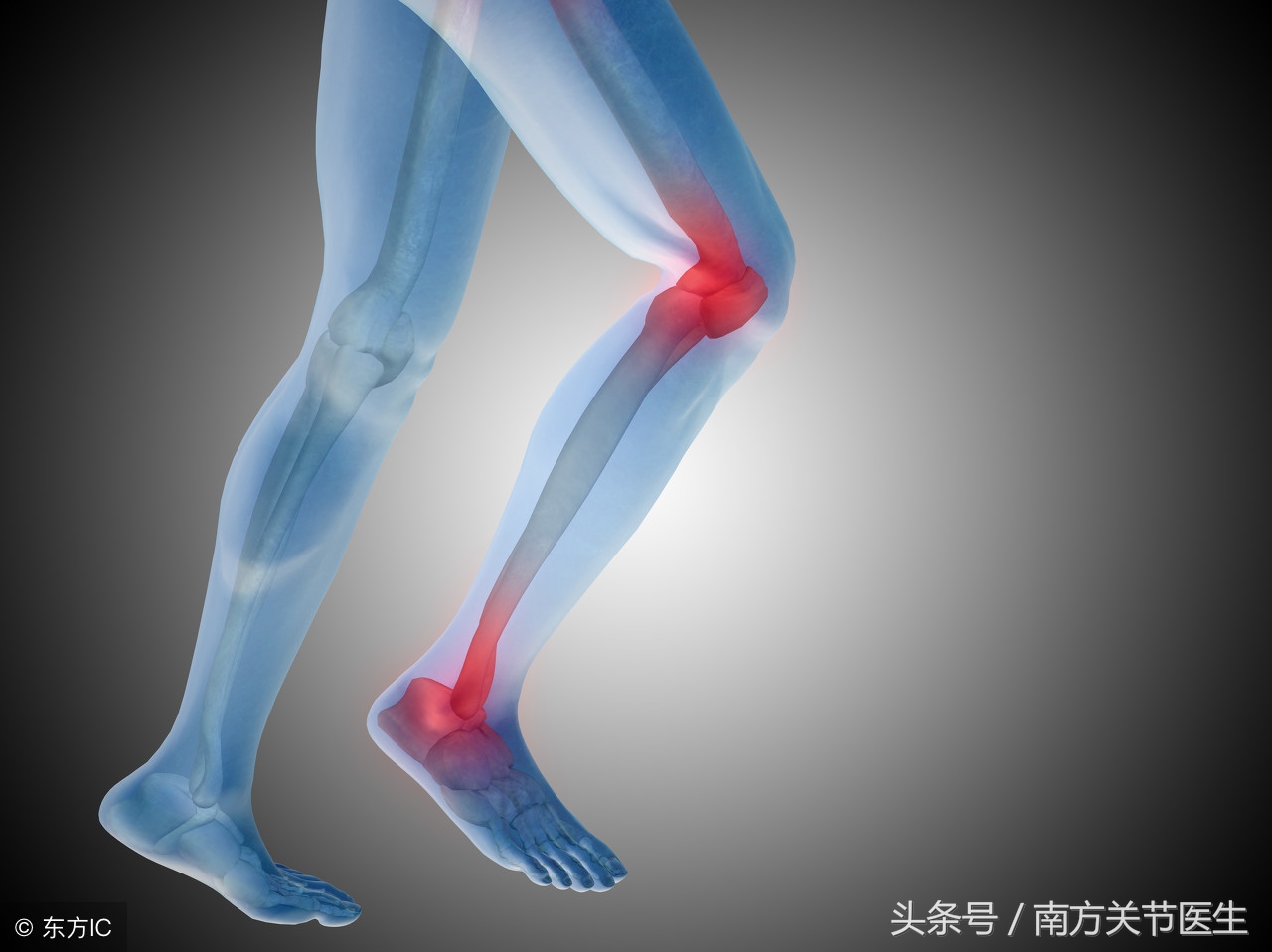 骨炎的原因,骨炎症状有哪些表现