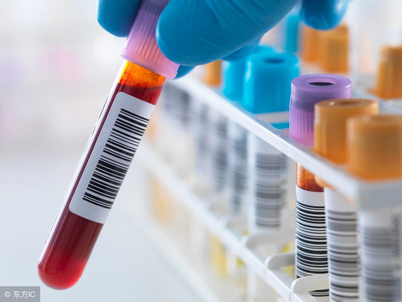 治愈艾滋病最新疗法,治愈艾滋病有新突破吗