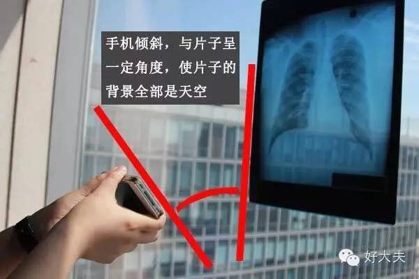 家里怎么拍片子给医生,如何把拍的ct片发给医生