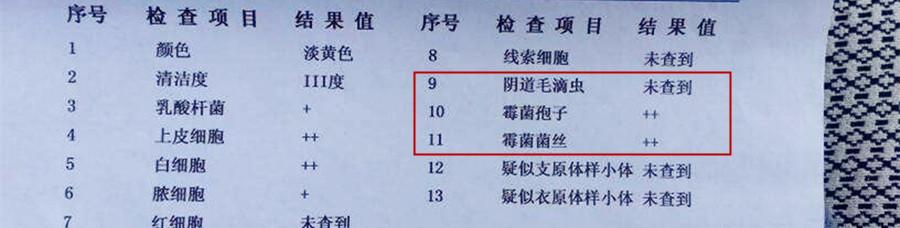 最全的孕检内容有什么,看产检单准确吗