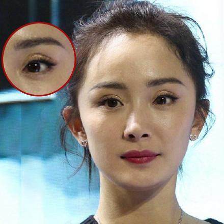 被双眼皮贴坑了的女星们,明星双眼皮李小璐