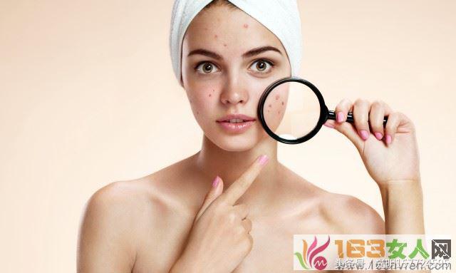 额头长痘的原因和调理方法,额头长痘怎么回事及调理方法