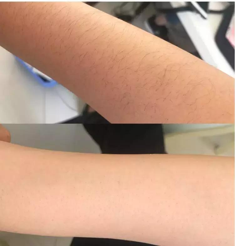 30块钱让你白到透明！不好用我撞豆腐！