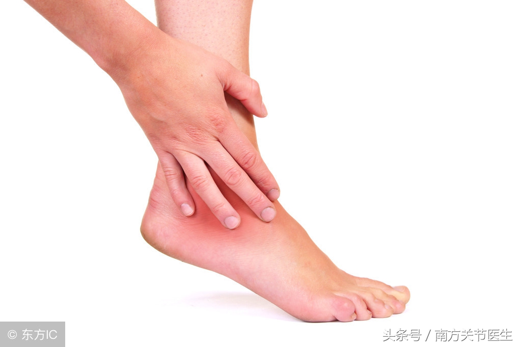 脚踝扭伤肿了怎么处理,脚踝扭伤12天还有肿能下地行走吗