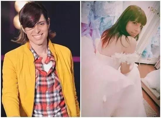 变性手术韩国网红,千万网红自曝变性后遗症