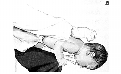 男童卡喉险窒息路过护士60秒救回,男童硬币卡喉公安护送