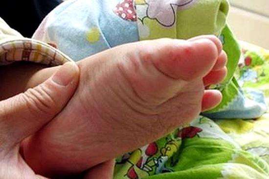 麻疹水痘猩红热的出疹时间,水痘手足口病症状