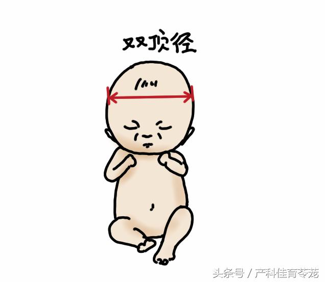 产科彩超报告解读,教您看懂产科超声报告