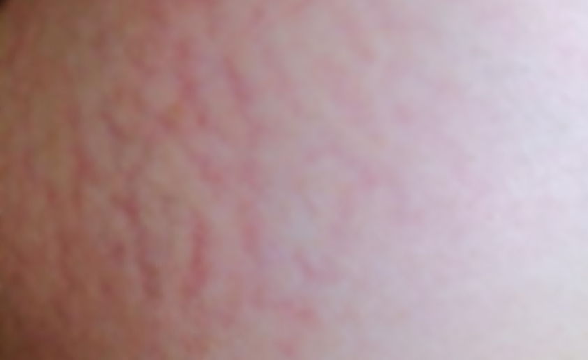 涂润肤乳能防妊娠纹吗,防止妊娠纹韩国产品