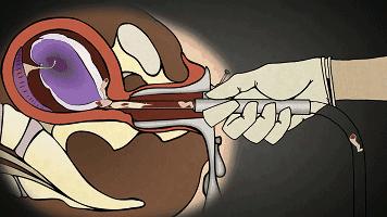 微信新套路：给男朋友发这句话，看他会怎么回复你？