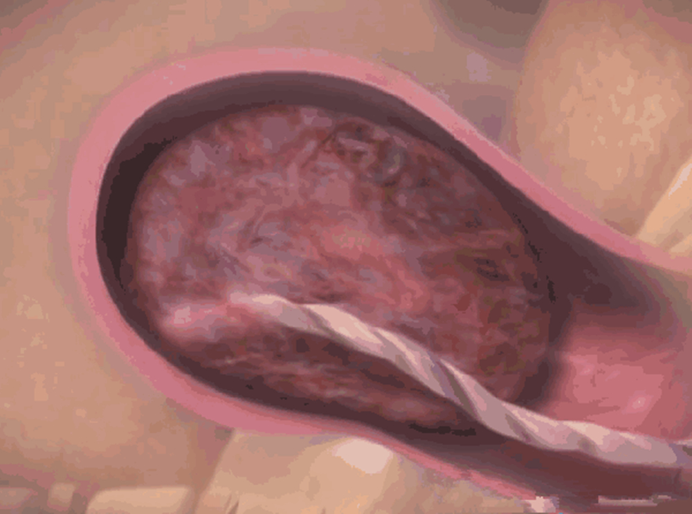 产妇感动到哭的视频,产妇痛哭视频完整版