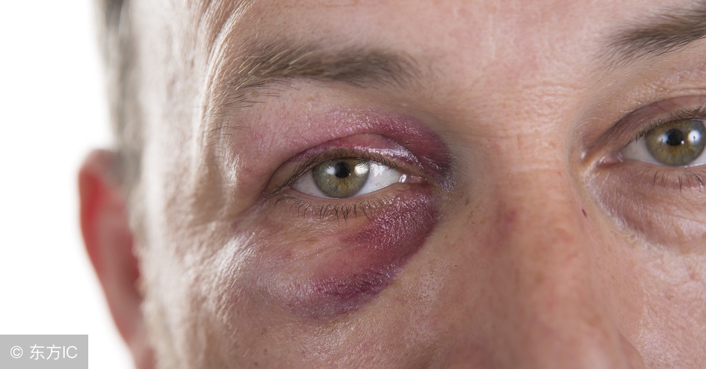 肾有问题在脸上会有什么症状,肾好不好从脸上看出来